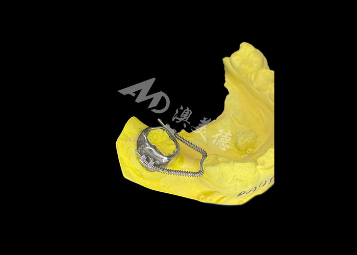 Schiebe-Loop-Regainer für eine effektive Raumwiederherstellung und präzise Zahnbewegung zur optimalen Ausrichtung bei orthodontischen Behandlungen