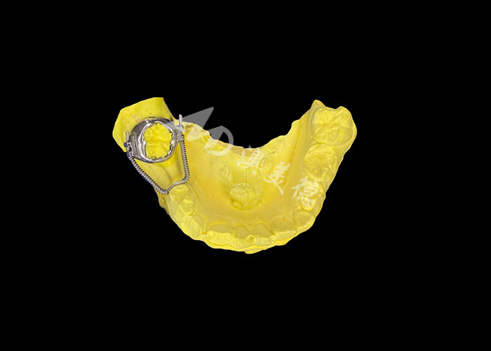 Schiebe-Loop-Regainer für eine effektive Raumwiederherstellung und präzise Zahnbewegung zur optimalen Ausrichtung bei orthodontischen Behandlungen