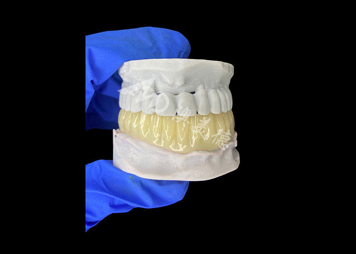 Leichtgewicht Biokompatible 3D-gedruckte Hohlzeitbrücke für Vorimplantat-Restaurationen