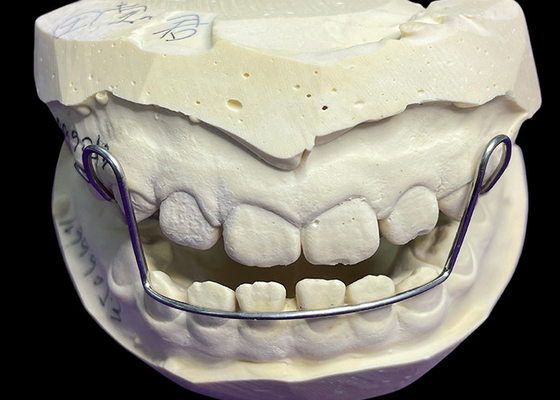 Guter Preis Führungsbogen-Gerät Orthodontik-Retiner Ausrichtungsgeräte mit guter Aufbewahrung Bewährte Bequemlichkeit Online