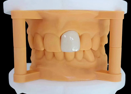 Guter Preis Transluzente Zirkonia Zahnkrone mit ästhetischer Leistung aus China Dental Lab Online
