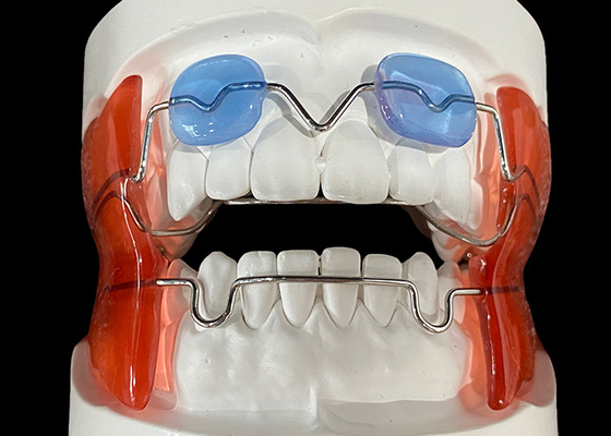 Guter Preis Frankel 2/3 Orthodontikgerät zur Verbesserung der Kieferausrichtung bei wachsenden Kindern Online