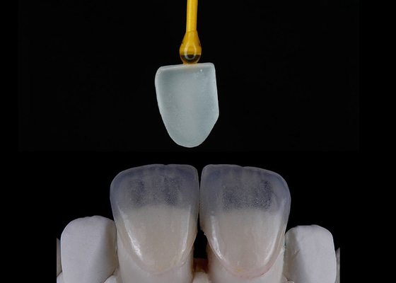 Guter Preis Maßgeschneiderte Zahnrestaurierung EMAX Veneers schön ausgerichtete digitale Abdrücke Online
