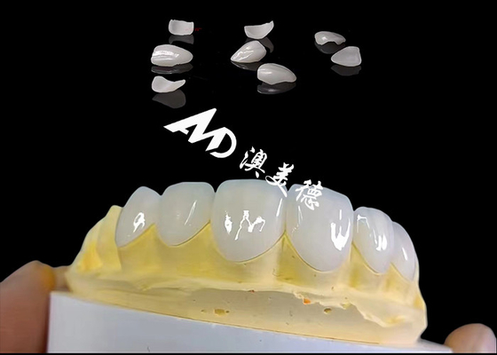 Guter Preis Translucency IPS Emax Veneers, minimale Vorbereitung Emax Zahn Veneers Online