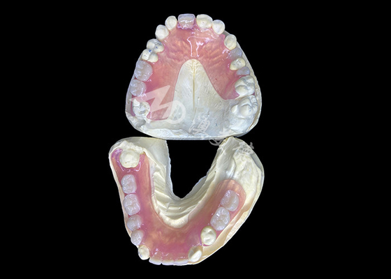 Guter Preis Valplast Flexible Partial Prothese für höchsten Komfort und ästhetische Attraktivität Online