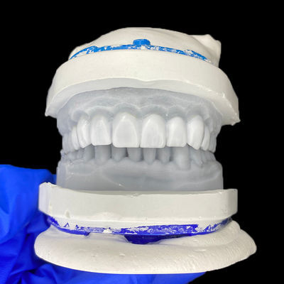 Guter Preis Diagnostic Wax-Up for Porcelain Veneers Online