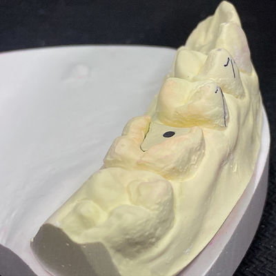 Guter Preis Reinforce Your Restoration with Lock Pink Post Core Technology Online