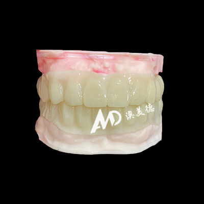 Guter Preis PMMA Hollow Temporary Bridges for Implant Provisional Cases Online