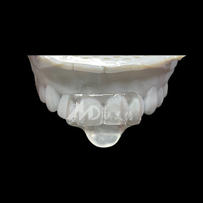 Guter Preis Custom Mini Nachtwache Orthodontik Gerät für Bruxismus, Occlusal Schutz und komfortable Nachtkleidung Online