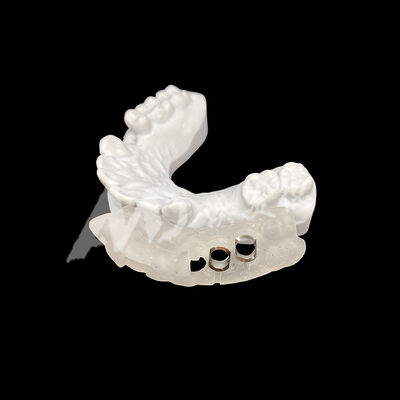 Guter Preis Präzise 3D-gedruckte chirurgische Implantat-Anleitung mit hoher Verfärbungsbeständigkeit unter Verwendung von CAD/CAM-Frästechnologie Online