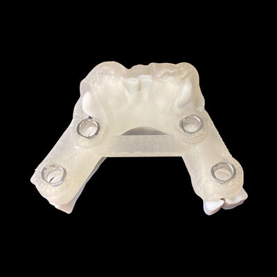 Guter Preis Digitale Implantatchirurgische Anleitung mit Implantatplanungsbericht Online